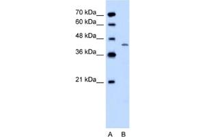 Western Blotting (WB) image for anti-Dihydroorotate Dehydrogenase (DHODH) antibody (ABIN2462506) (DHODH 抗体)
