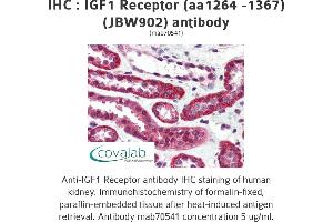 Image no. 2 for anti-Insulin-Like Growth Factor 1 Receptor (IGF1R) (AA 1264-1367) antibody (ABIN1723400) (IGF1R 抗体  (AA 1264-1367))