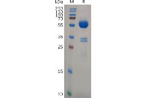 Human CD74(73-232) Protein, hFc Tag on SDS-PAGE under reducing condition. (CD74 Protein (Fc Tag))