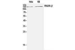 Western Blot analysis of Hela, KB cells using PDGFRB Polyclonal Antibody at dilution of 1:1000. (PDGFRB 抗体)