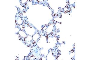 Immunohistochemistry of paraffin-embedded rat lung using  Rabbit mAb (ABIN7265434) at dilution of 1:100 (40x lens). (ADAM15 抗体)