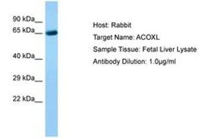 Image no. 1 for anti-Acyl-CoA Oxidase-Like (ACOXL) (AA 361-410) antibody (ABIN6750231) (ACOXL 抗体  (AA 361-410))