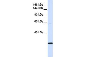 SMC2 antibody used at 1 ug/ml to detect target protein. (SMC2 抗体  (N-Term))