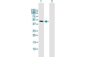 Western Blot analysis of VIL1 expression in transfected 293T cell line by VIL1 MaxPab polyclonal antibody. (Villin 1 抗体  (AA 1-421))