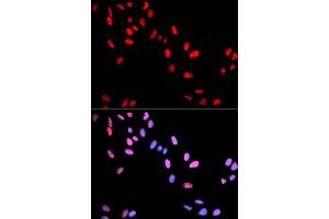 Immunofluorescence analysis of U2OS cells using Phospho-MYC-T58 antibody (ABIN5969925). (c-MYC 抗体  (pThr58))