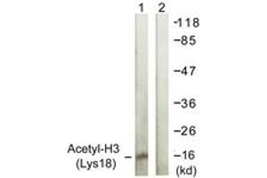 Western Blotting (WB) image for anti-Histone 3 (H3) (H3K18ac) antibody (ABIN2879163) (Histone 3 抗体  (H3K18ac))