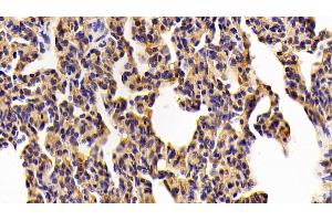 Detection of TLR2 in Porcine Lung Tissue using Polyclonal Antibody to Toll Like Receptor 2 (TLR2) (TLR2 抗体  (AA 47-245))