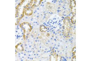 Immunohistochemistry of paraffin-embedded rat kidney using STRN3 antibody at dilution of 1:100 (x40 lens). (STRN3 抗体)