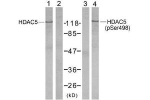 Western blot analysis of extract from NIH/3T3 cells using HDAC5 (Ab-498) antibody (E021142, Lane 1 and 2) and HDAC5 (phospho-Ser498) antibody (E011193, Lane 3 and 4). (HDAC5 抗体  (pSer498))