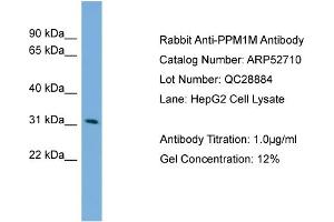 WB Suggested Anti-PPM1M  Antibody Titration: 0. (PPM1M 抗体  (Middle Region))