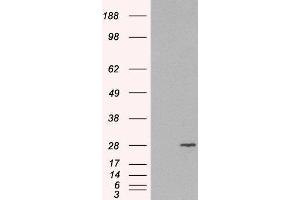 HEK293 overexpressing RAB11A and probed with ABIN2564836 (mock transfection in first lane). (RAB11A 抗体  (C-Term))
