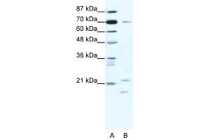 BTF3 antibody (20R-1189) used at 0. (BTF3 抗体  (Middle Region))