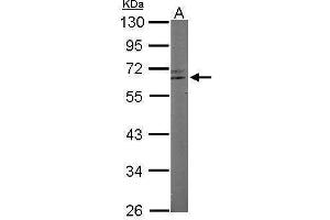 WB Image Sample (50 ug of whole cell lysate) A: Mouse brain 10% SDS PAGE antibody diluted at 1:1000 (RAP1 抗体  (Center))