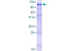 Image no. 1 for Dipeptidylpeptidase 10 (DPP10) (AA 1-796) protein (GST tag) (ABIN1351946) (DPP10 Protein (AA 1-796) (GST tag))