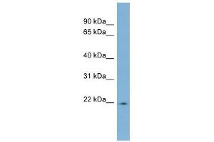 LBX2 antibody used at 0. (LBX2 抗体  (Middle Region))