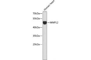 Western blot analysis of extracts of Human heart using MMP12 Polyclonal Antibody. (MMP12 抗体)