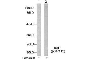 Image no. 2 for anti-BCL2-Associated Agonist of Cell Death (BAD) (pSer112), (pSer75) antibody (ABIN196735) (BAD 抗体  (pSer75, pSer112))