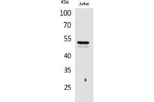 Western Blot analysis of Jurkat cells using Acetyl-Tubulin α (K40) Polyclonal Antibody. (alpha Tubulin 抗体  (acLys40))