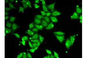 Immunofluorescence analysis of HeLa cells using ATXN3 antibody (ABIN5970585). (Ataxin 3 抗体)