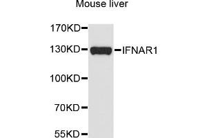 Western blot analysis of extracts of mouse liver, using IFNAR1 antibody (ABIN5970858) at 1/1000 dilution. (IFNAR1 抗体)