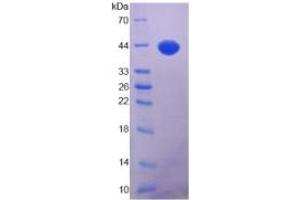 SDS-PAGE of Protein Standard from the Kit  (Highly purified E. (IGF1 ELISA 试剂盒)