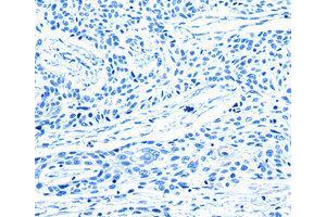 Immunohistochemistry (IHC) image for anti-G Protein-Coupled Receptor Kinase 1 (GRK1) antibody (ABIN1872898) (GRK1 抗体)