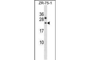 Western blot analysis in ZR-75-1 cell line lysates (35ug/lane). (CCDC140 抗体  (N-Term))