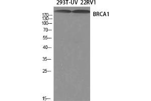 Western Blotting (WB) image for anti-Breast Cancer 1 (BRCA1) (Ser1423) antibody (ABIN5959016) (BRCA1 抗体  (Ser1423))