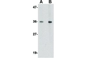 Western Blot of BRAL1 Antibody Western Blot of BRAL1 antibody. (HAPLN2 抗体  (Internal Region))