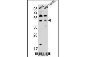 Western blot analysis in K562,MDA-MB453 cell line lysates (35ug/lane). (SNX29 抗体  (C-Term))