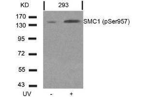 Western blot analysis of extracts from 293 cells untreated or treated with UV using SMC1(Phospho-Ser957) Antibody. (SMC1A 抗体  (pSer957))