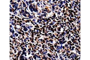 Immunohistochemistry (IHC) image for anti-S100 Calcium Binding Protein A4 (S100A4) antibody (ABIN2420929) (s100a4 抗体)