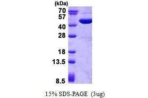 Figure annotation denotes ug of protein loaded and % gel used. (GOT2 蛋白)