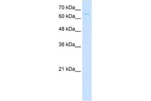 Western Blotting (WB) image for anti-CTP Synthase (CTPS) antibody (ABIN2462931) (CTP Synthase 抗体)