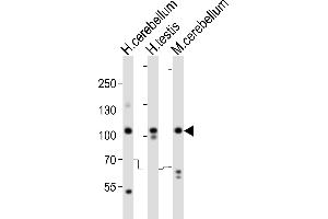 Western blot analysis of lysates from human cerebellum, human testis, mouse cerebellum tissue lysate (from left to right), using SKOR2 Antibody (C-term) (ABIN6244147 and ABIN6577773). (SKOR2 抗体  (C-Term))