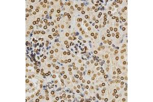 Immunohistochemistry (Paraffin-embedded Sections) (IHC (p)) image for anti-Lamin A/C (LMNA) (AA 403-572) antibody (ABIN3020785)