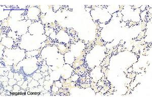 Immunohistochemical analysis of paraffin-embedded rat lung tissue. (JAK1 抗体  (pTyr1022))