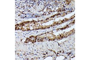 Immunohistochemistry of paraffin-embedded rat lung using GA antibody (ABIN6130412, ABIN6140923, ABIN6140926 and ABIN6215461) at dilution of 1:100 (40x lens). (GADD45A 抗体  (AA 1-165))