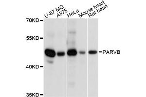 Western blot analysis of extracts of various cell lines, using PARVB antibody (ABIN6290187) at 1:3000 dilution. (Parvin, beta 抗体)