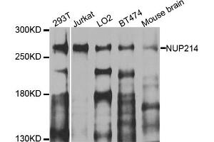 Western blot analysis of extracts of various cell lines, using NUP214 antibody (ABIN5974670) at 1/1000 dilution. (NUP214 抗体)