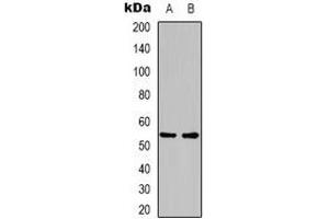 Western blot analysis of GLP-1 Receptor expression in mouse brain (A), rat brain (B) whole cell lysates. (GLP1R 抗体)