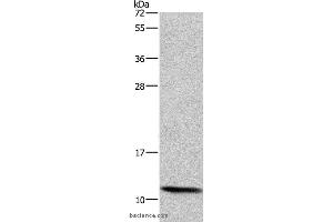 Western blot analysis of HepG2 cell, using HSPE1 Polyclonal Antibody at dilution of 1:750 (HSPE1 抗体)