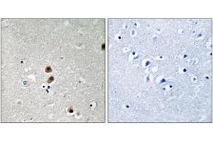 Immunohistochemistry analysis of paraffin-embedded human brain, using CtBP1 (Phospho-Ser422) Antibody. (CTBP1 抗体  (pSer422))