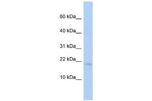 RFESD antibody used at 1 ug/ml to detect target protein. (RFESD 抗体)