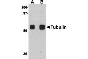 Western Blotting (WB) image for anti-alpha Tubulin (TUBA1) (N-Term) antibody (ABIN1031226) (alpha Tubulin 抗体  (N-Term))