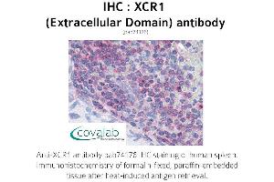 Image no. 1 for anti-Chemokine (C Motif) Receptor 1 (XCR1) (3rd Extracellular Domain) antibody (ABIN1740868) (XCR1 抗体  (3rd Extracellular Domain))