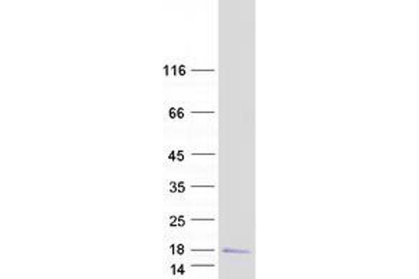 MRPS33 Protein (Transcript Variant 2) (Myc-DYKDDDDK Tag)