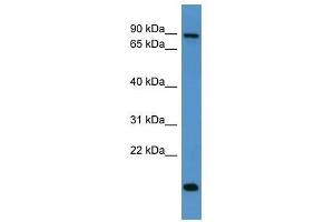 App antibody used at 0. (APP 抗体  (C-Term))