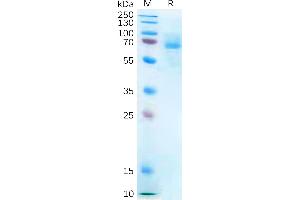 Human P2RX7 Protein, hFc Tag on SDS-PAGE under reducing condition. (P2RX7 Protein (Fc Tag))