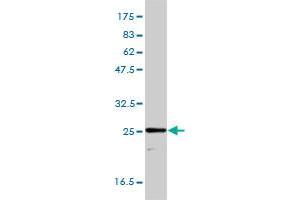 TPI1 monoclonal antibody (M01), clone 1D10-2E2 Western Blot analysis of TPI1 expression in HepG2 . (TPI1 抗体  (AA 1-249))